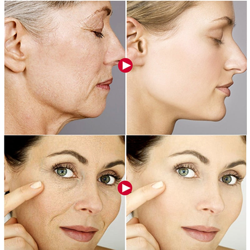 Anti-Aging Removing Wrinkles